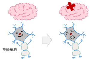 失語症 症状 チェック 失語症 症状 チェック
